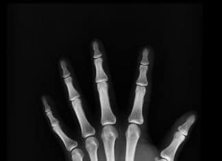 Gesunde Knochen – eine Aufgabe?