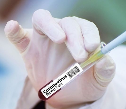 Aktuelle Infos zur Corona-Lage in Kärnten