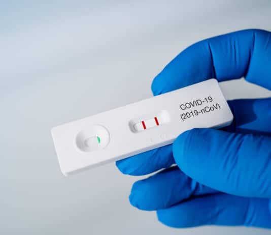 Sozialpartner-Appell für COVID-Test