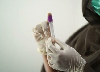 Usutu-Virus wurde in der Region Friaul nachgewiesen