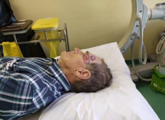 Neue Methode bei der Behandlung von weißem Hautkrebs