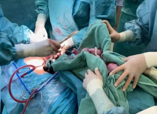 Erstmalige Frühchenversorgung an der Nabelschnur nach Spontangeburt