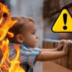 Schwere Verletzungsgefahr: Kinderchirurgen warnen vor Verbrennungen in der Weihnachtszeit