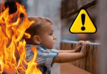 Schwere Verletzungsgefahr: Kinderchirurgen warnen vor Verbrennungen in der Weihnachtszeit