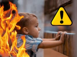 Schwere Verletzungsgefahr: Kinderchirurgen warnen vor Verbrennungen in der Weihnachtszeit